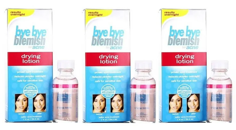 Hiệu quả kem trị mụn Bye Bye Blemish