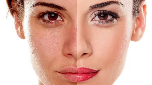 Kem dưỡng làm trắng da, trị sạm nám Obagi Nu-Derm Blend Fx