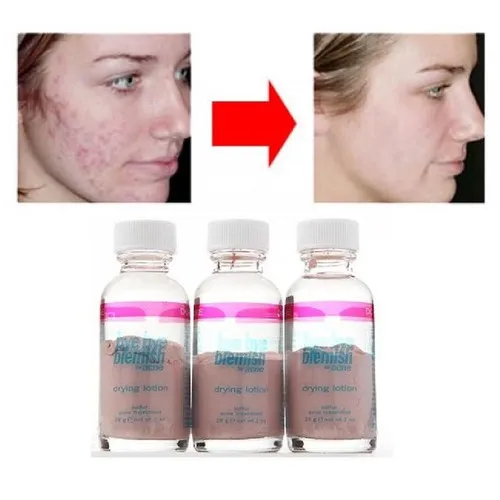 Thiết kế sản phẩm Bye Bye Blemish